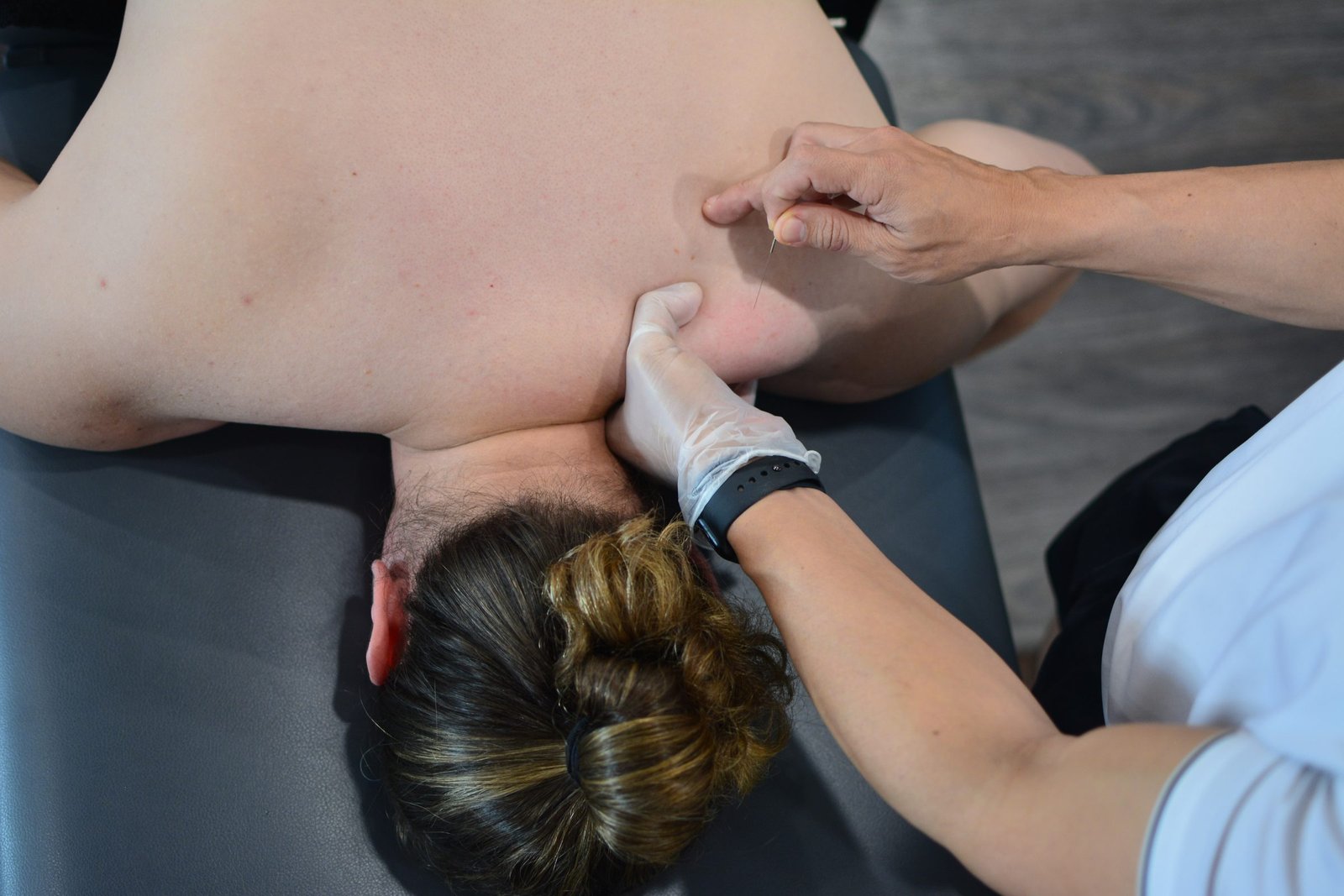 A physiotherapist performing dry needling on a patient's shoulder at Axis33