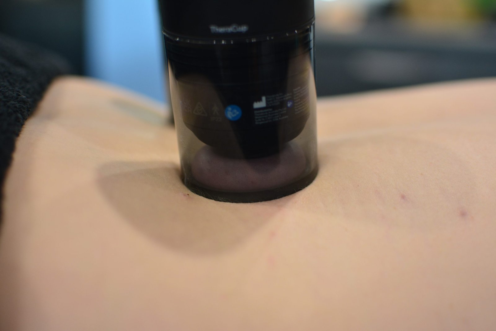 Cupping therapy device in use during a treatment session at Axis33